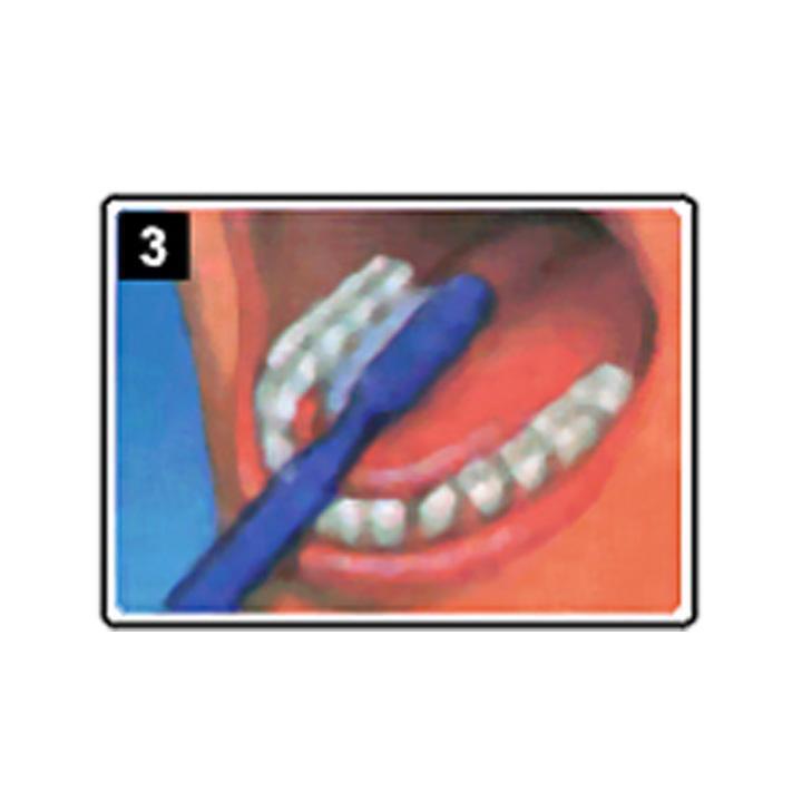 dentiste-chablais-article-hygiene-detartrage-brossage-03