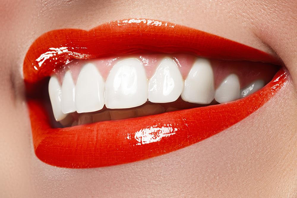 Lèvres rouges, dents blanches