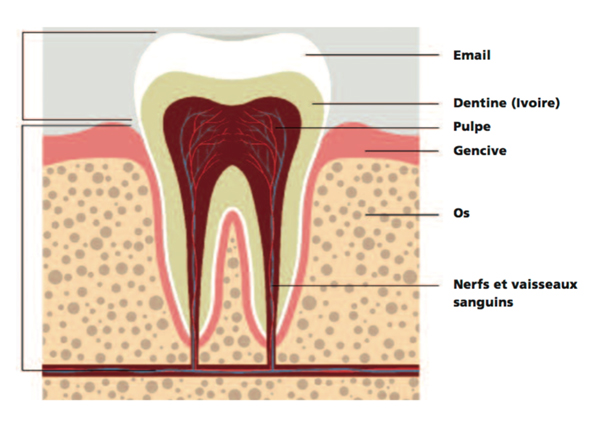 Lorsque le nerf d’une dent se fait lancinant