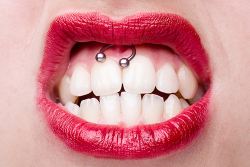 Piercings : préférer le plastique au métal