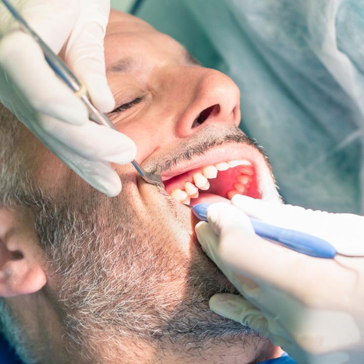 dentiste-chablais-article-chirurgie-orale-02